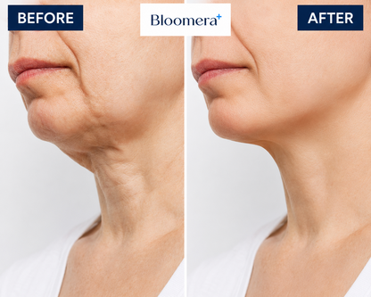 Bloomera NeckTighten Technology®