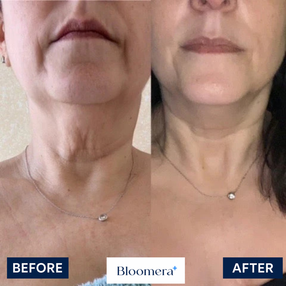 Face-to-Neck Age Gap Elixir image 2