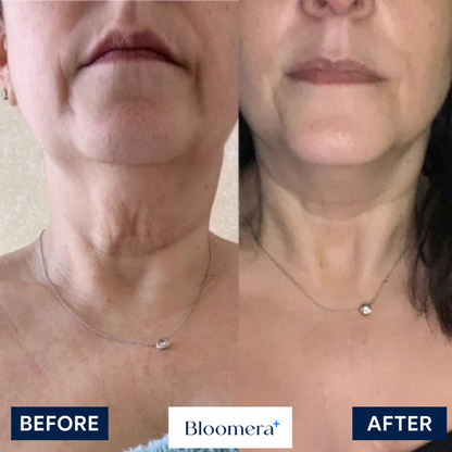 Bloomera NeckTighten Technology®