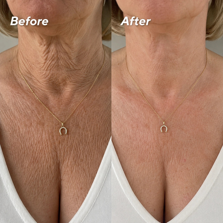 Firms The Look Of Loose Neck Skin
